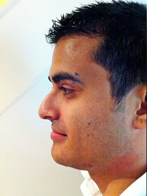 Before & After images - Nose jobs for men